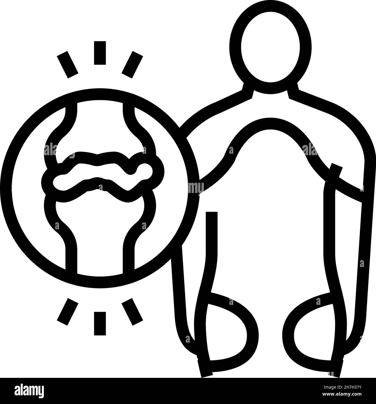 illustration du vecteur de la ligne polymyalgie rhumatismale Illustration de Vecteur