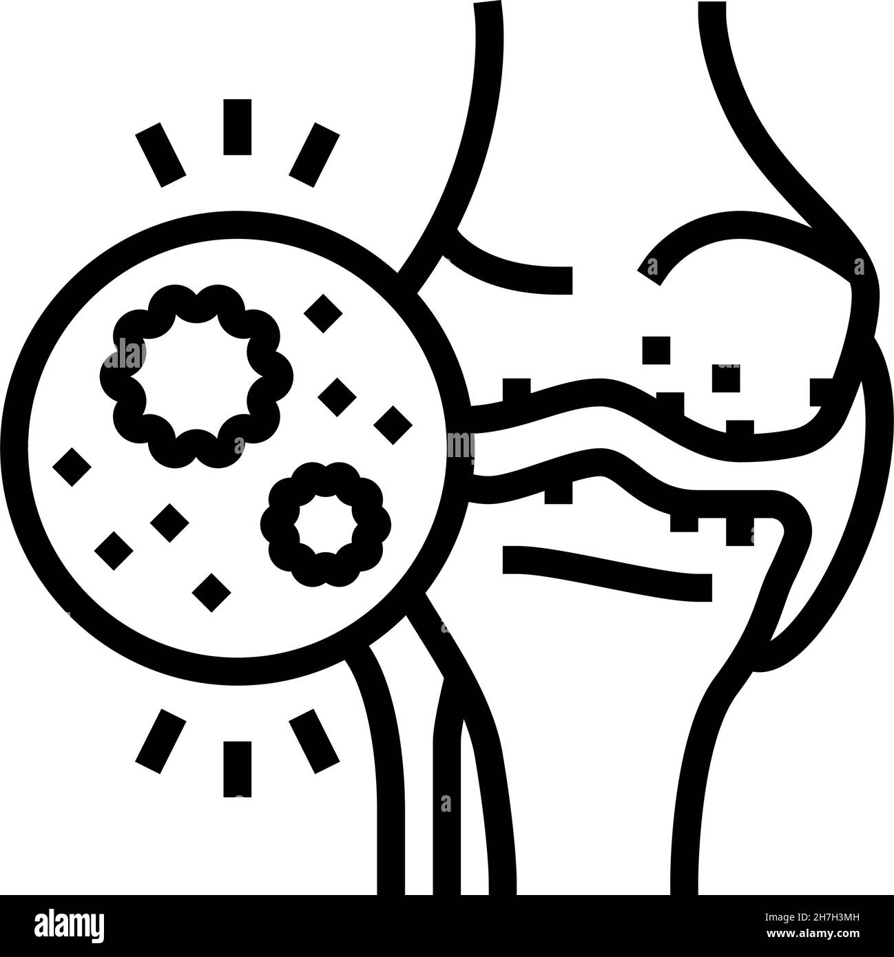 illustration vectorielle de l'icône de la ligne d'arthrite infectieuse Illustration de Vecteur
