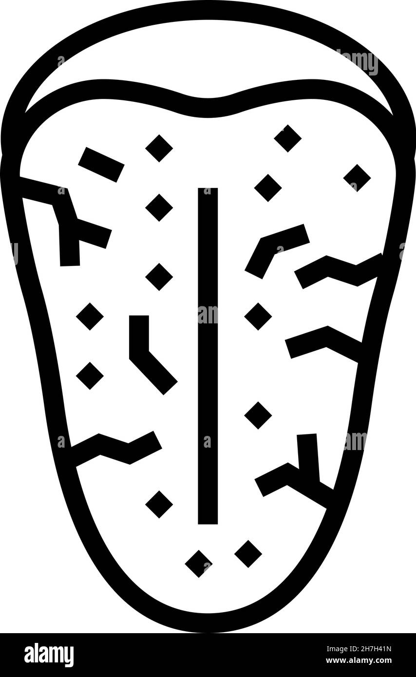 illustration du vecteur de la ligne du syndrome de sjogrens Illustration de Vecteur