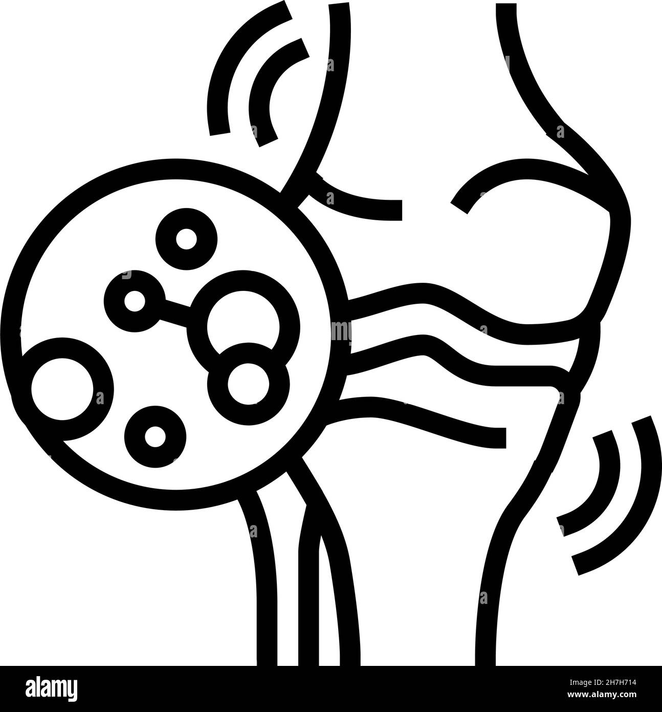 illustration du vecteur de l'icône de la ligne d'arthrite idiopathique juvénile Illustration de Vecteur