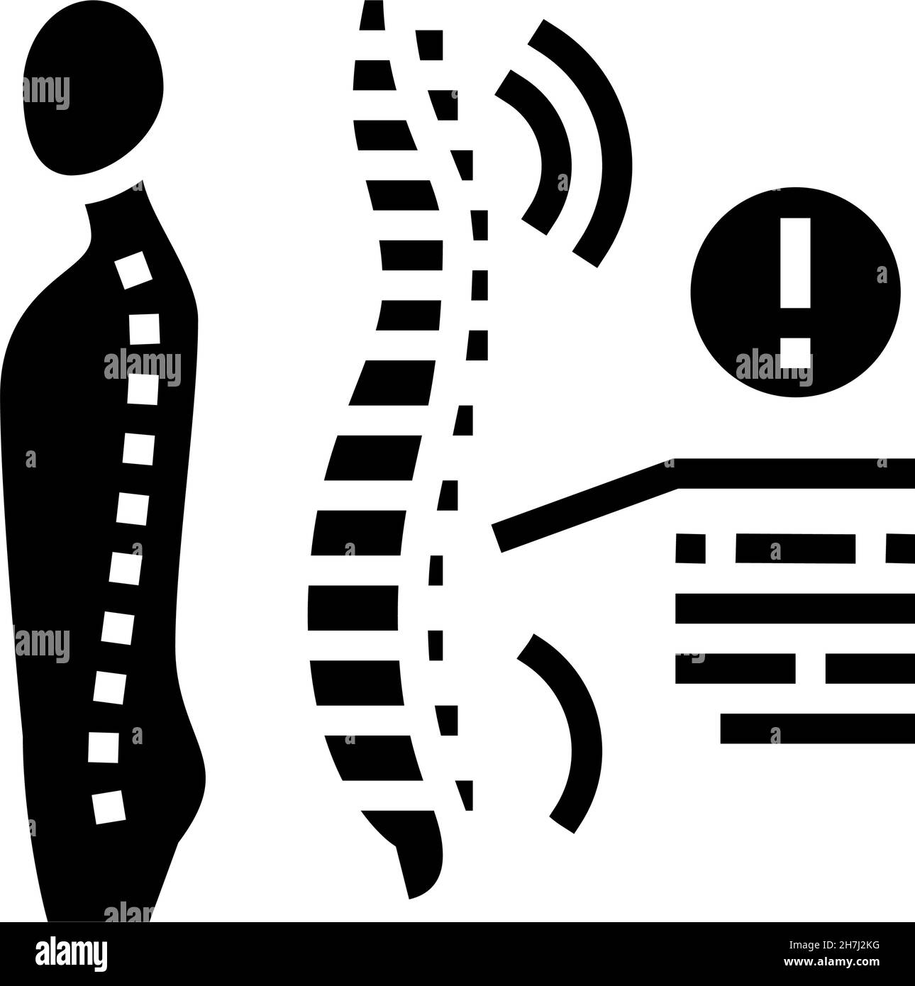 spondyloarthropathies problème de santé glyphe icône illustration du vecteur Illustration de Vecteur
