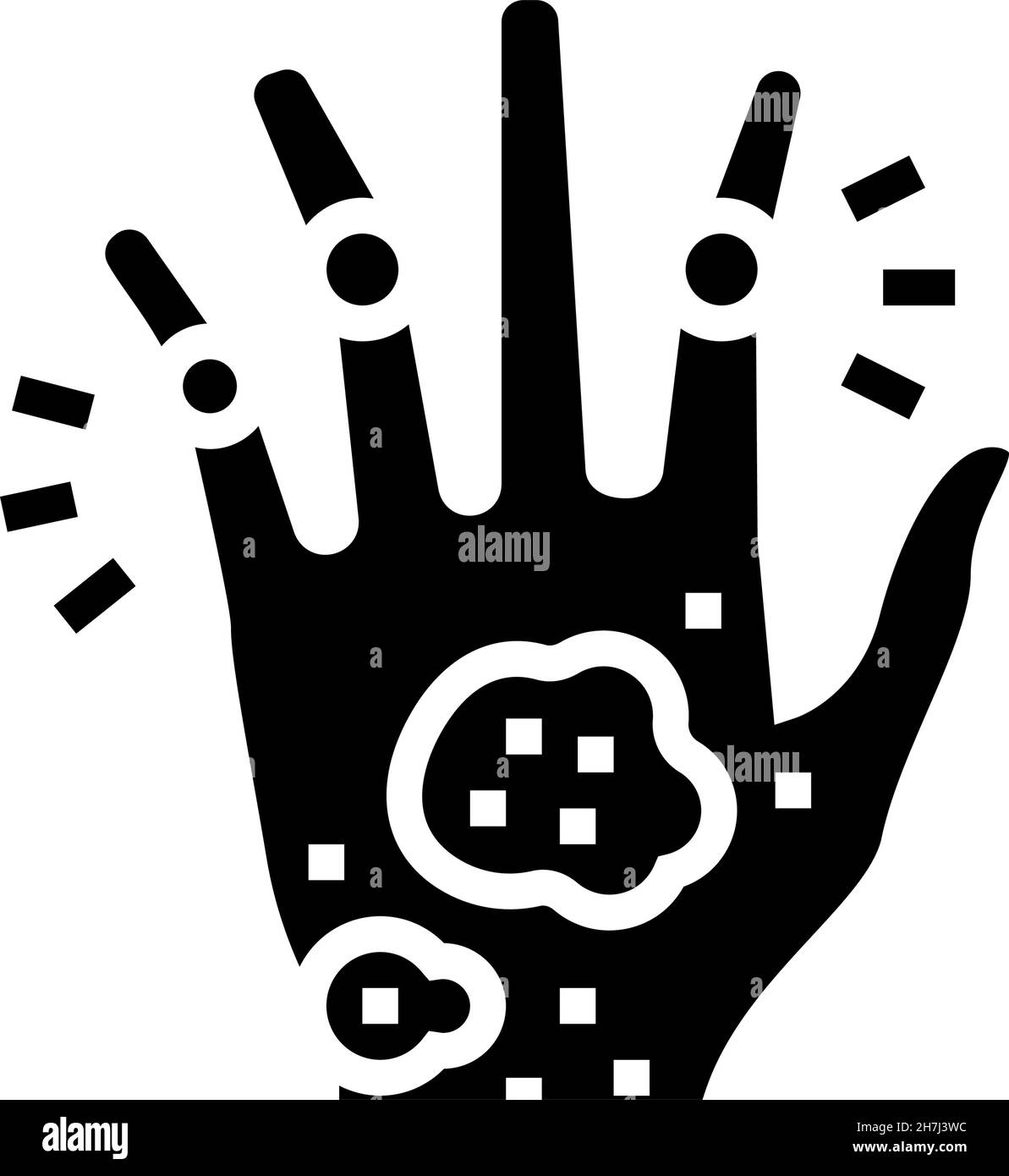 arthrite psoriasique problème de santé de la peau glyphe icône illustration du vecteur Illustration de Vecteur