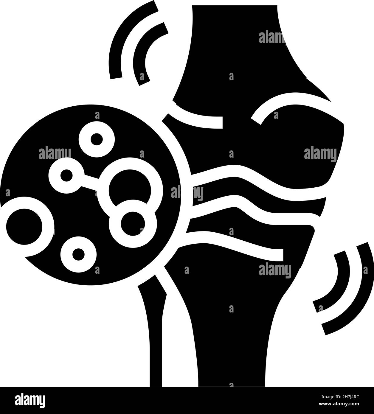 illustration d'un vecteur d'icône de glyphe d'arthrite idiopathique juvénile Illustration de Vecteur