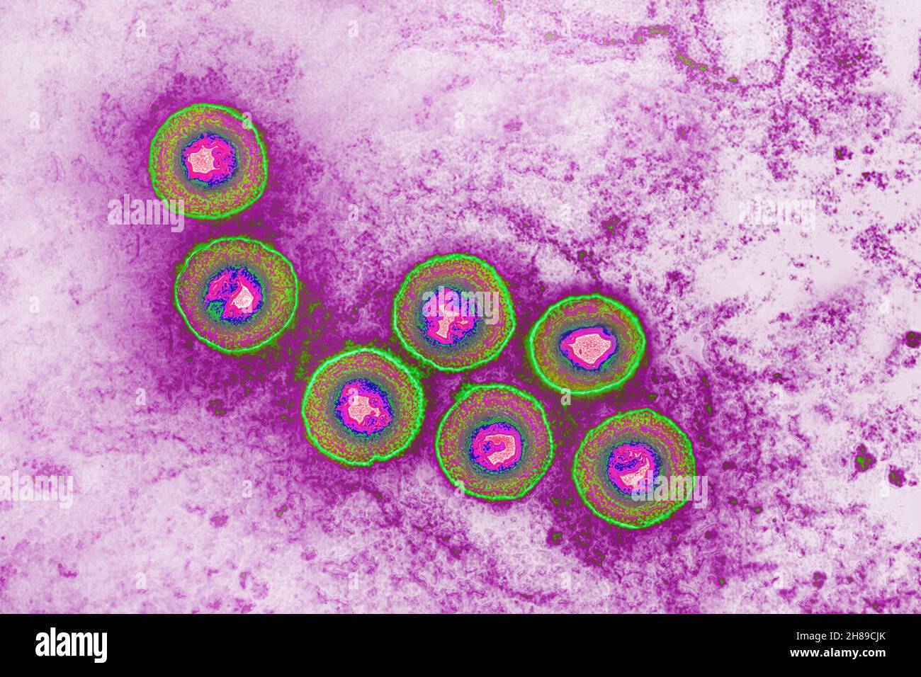 Virus de l’herpès Banque D'Images