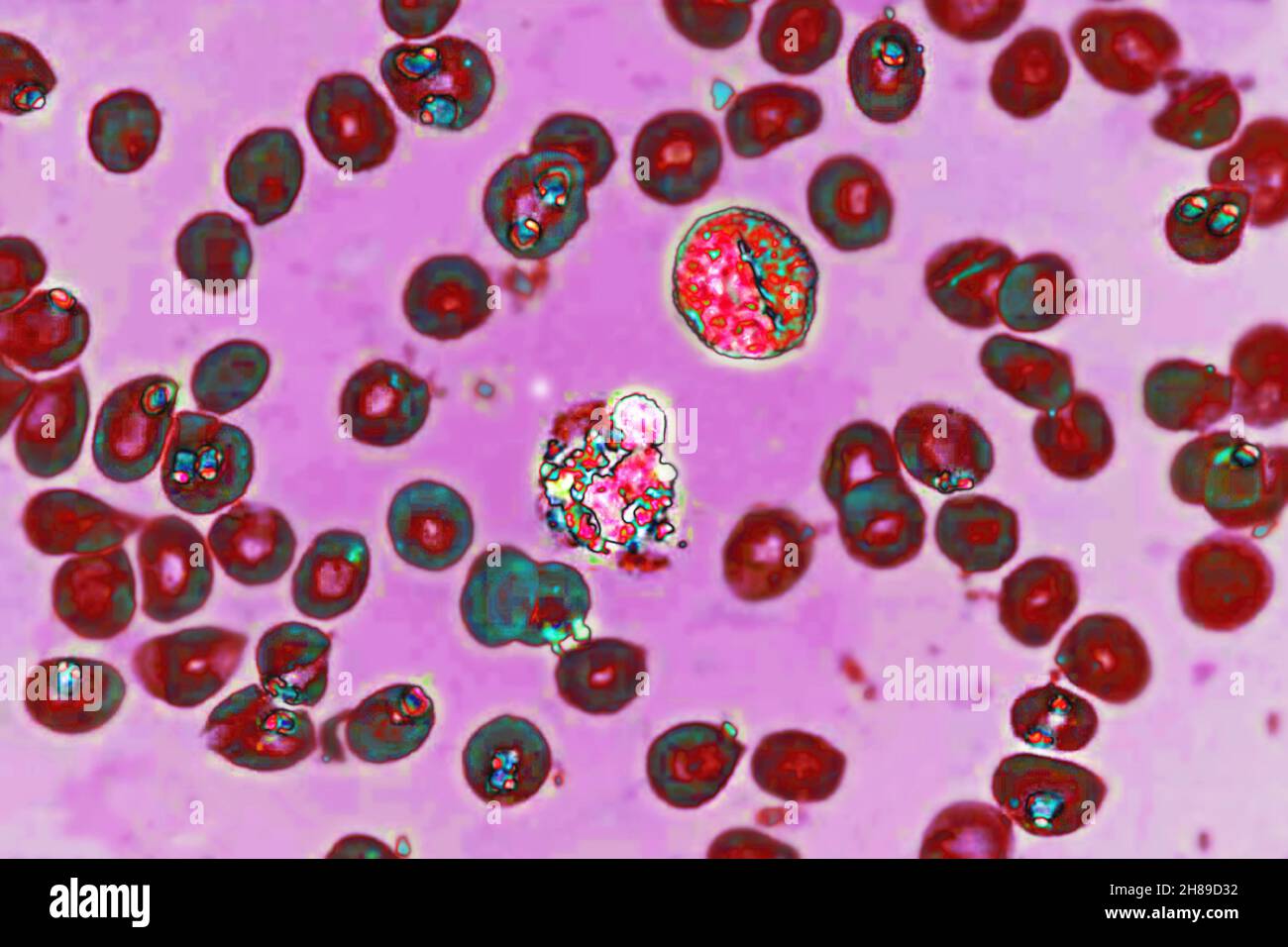 Plasmodium falciparum Banque D'Images