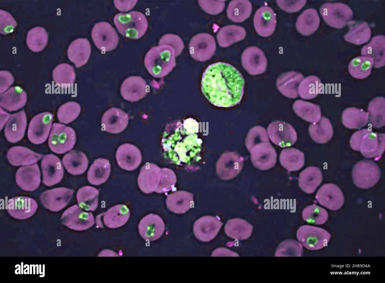 Plasmodium falciparum Banque D'Images