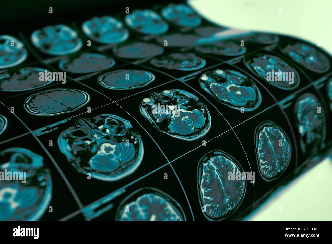 Film d'examen IRM de la tête du patient comme base de diagnostic médical. Banque D'Images