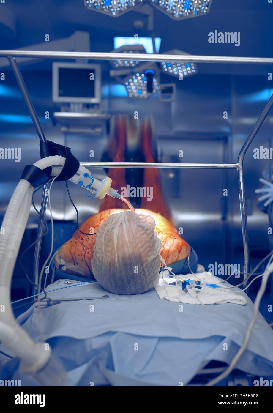 Patient endormi sur la table d'opération préparée à la chirurgie. Banque D'Images