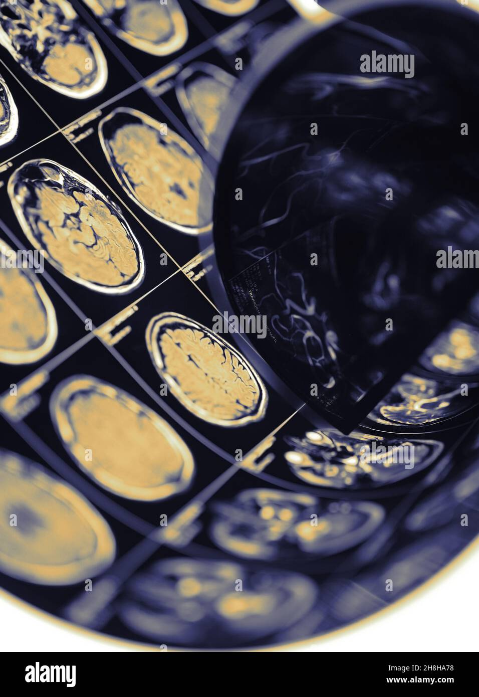 Image CT du cerveau humain comme concept d'inspection diagnostique. Banque D'Images