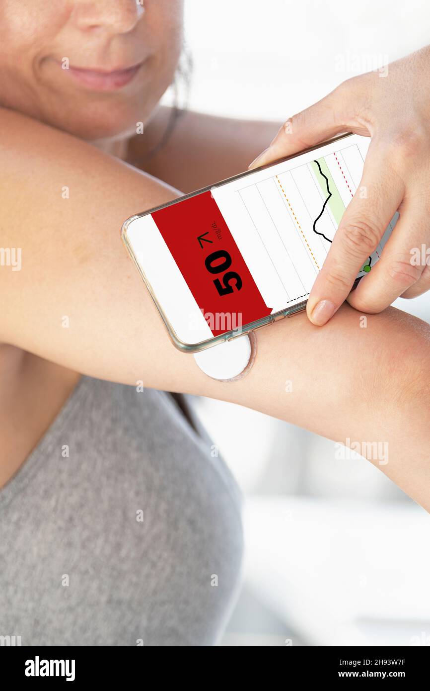 Femme diabétique surveillant et vérifiant le niveau de glucose avec un capteur à distance et une nouvelle technologie avec une application dans un smartphone Banque D'Images
