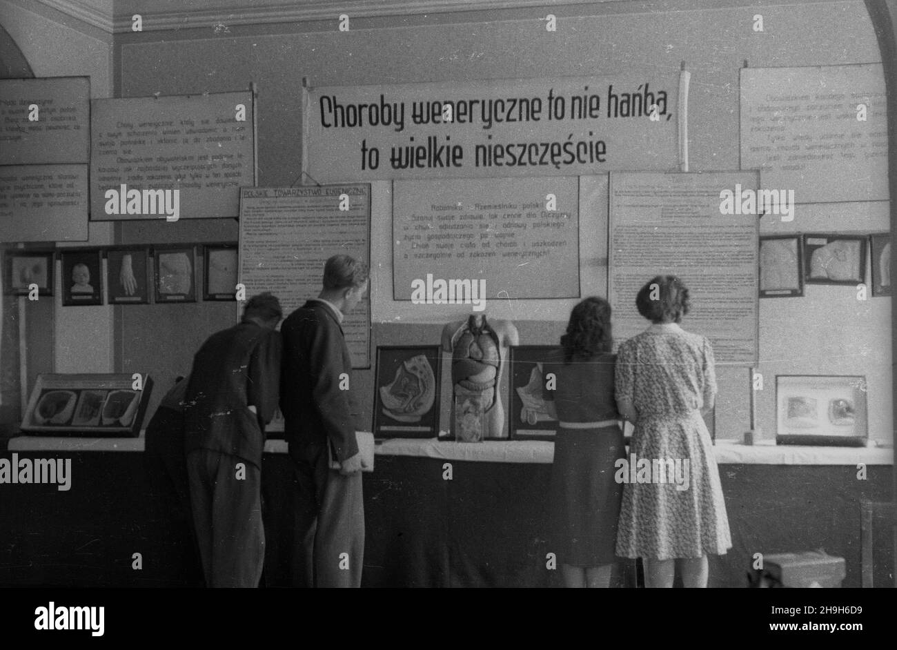 Varsovie, 1948-07.W celu zwalcznia chorób wenerycznych Ministerstwo Zdrowia podjê³o W roku 1948, na terenie ca³ej Polski, szeroko zakrojon¹ akcjano profilaktyczn¹ pod nazw¹ Akcja W. W ca³ym kraenerwywieszono plakaty, zorganizowano objazdowe wana ambulo nazwumzwo kwumzwumzwu wumzoszwo, wotwotwotwo wyk³ady wotwo wotwotwotwotwotzNZ. Wystawa przeciwweneryczna W siedzibie Spo³eczno-Obywatelskiej Ligi Kobiet. mta PAP Dok³adny dzieñ wydarzenia nieustalony.Varsovie, juillet 1948.Le ministère de la Santé a lancé en 1948, calle, une vaste campagne de prévention de la maladie générale en Pologne Banque D'Images