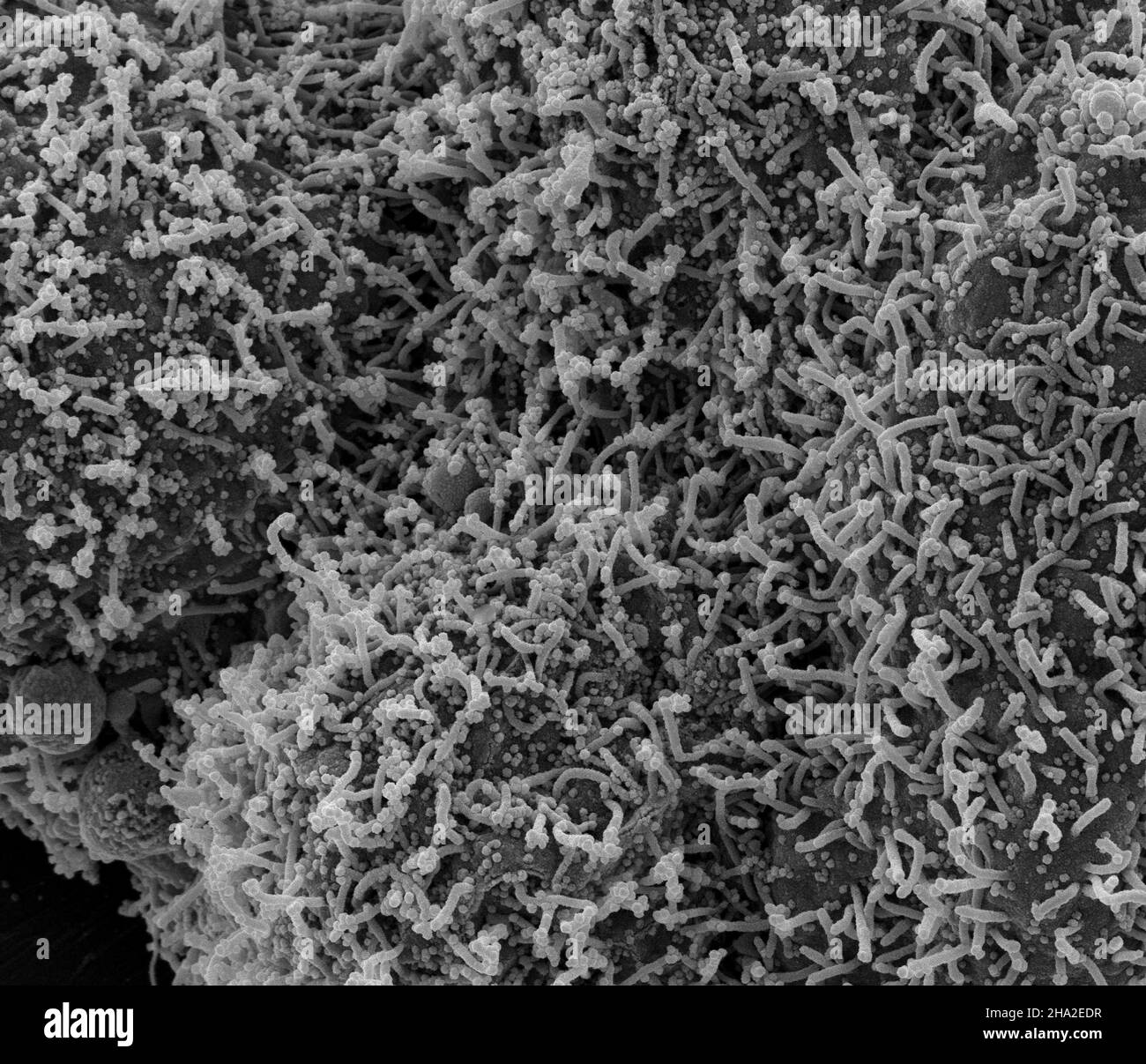 Nouveau coronavirus sras-cov-2 Banque D'Images