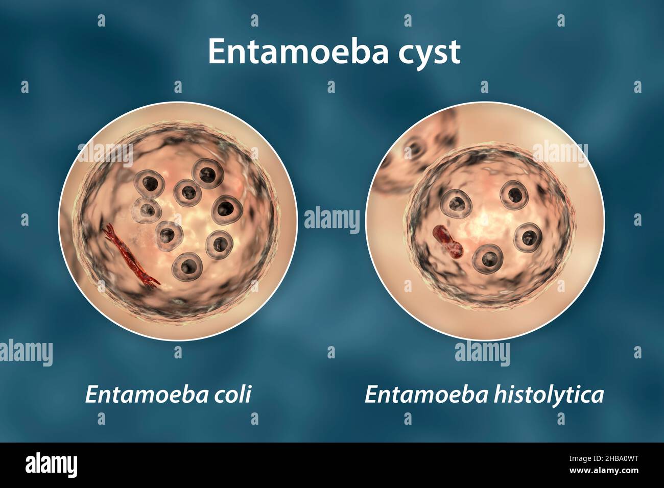 Kystes d'Entamoeba protozoans, E. coli et E. histolityca, illustration informatique.E. coli est un amibe non pathogène, son kyste est de 15-25 micromètres, possède huit noyaux et une barre chromatoïdale allongée avec des extrémités fracturées (rouge foncé).E. histolytica est un protozoaire parasite qui provoque une dysenterie amibienne chez l'homme après l'ingestion de kystes infectieux dans des aliments ou de l'eau contaminés.Le kyste mature de E. histolytica est de 10-20 micromètres, possède quatre noyaux et une barre chromatoïdale allongée arrondie (rouge foncé). Banque D'Images