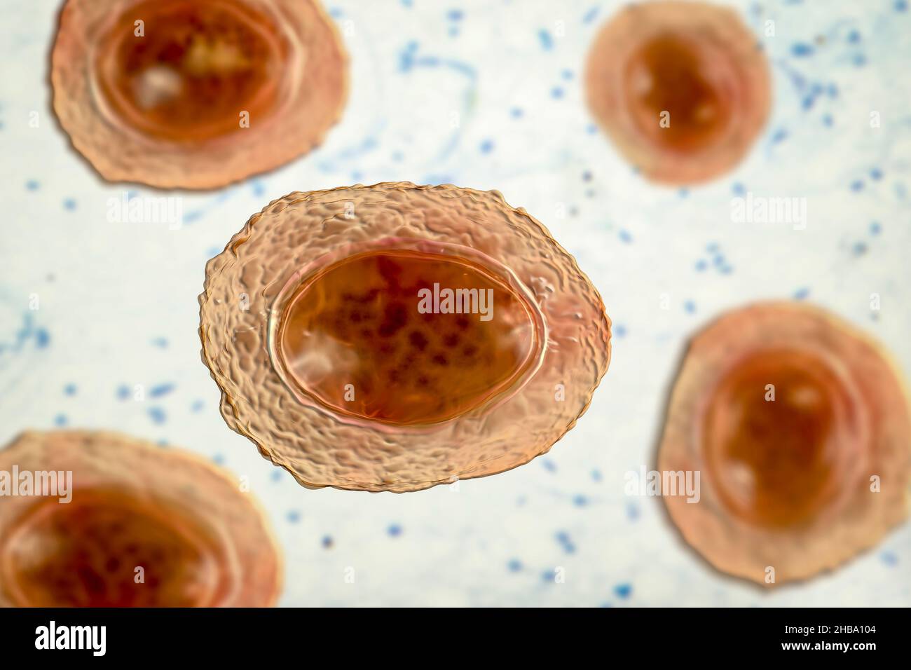 Oeufs non fécondés d'Ascaris lumbricoides, illustration.Les oeufs ont un épais boîtier de protection, ces oeufs à coque épaisse peuvent survivre à des conditions défavorables de sécheresse, enfouies dans le sol.Le ver adulte (jusqu'à 35cm de long) est un parasite intestinal des humains.L'infestation peut causer des douleurs abdominales, des vomissements, de la constipation, de la malnutrition et de l'anémie.Le ver femelle pond un grand nombre d'œufs dans l'intestin humain qui sont excrétés dans les fèces et ingérés par un nouvel hôte par l'intermédiaire d'eau ou de nourriture contaminée.Cette infection est connue sous le nom d'ascariasis. Banque D'Images