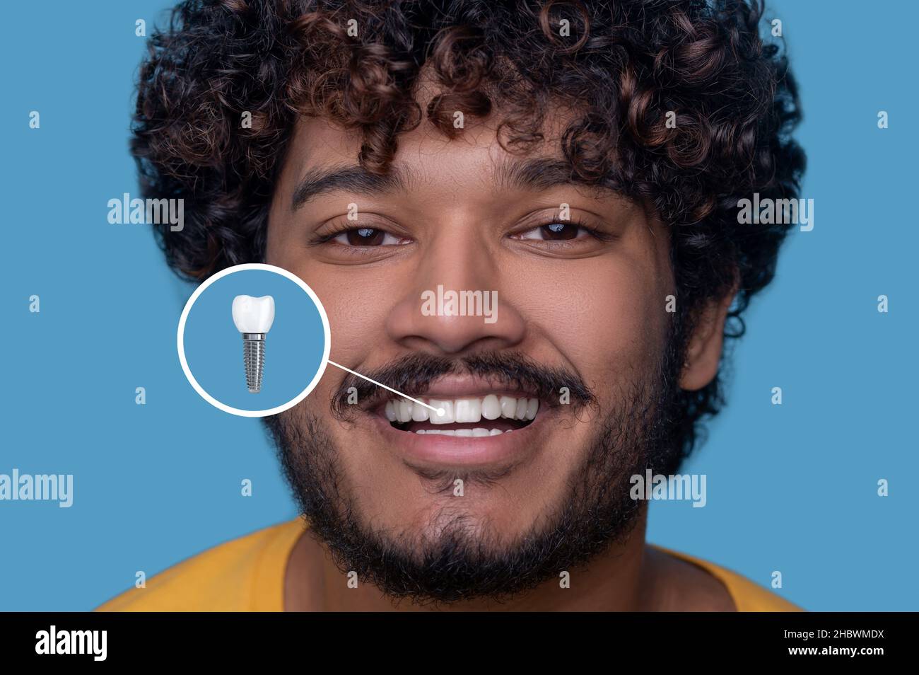 Jeune homme avec un sourire crasseux démontrant son implant dentaire Banque D'Images