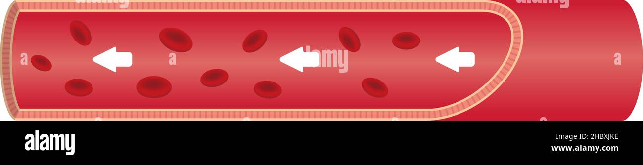 Illustration Vestor de l'aorte normale (pas de texte) Illustration de Vecteur