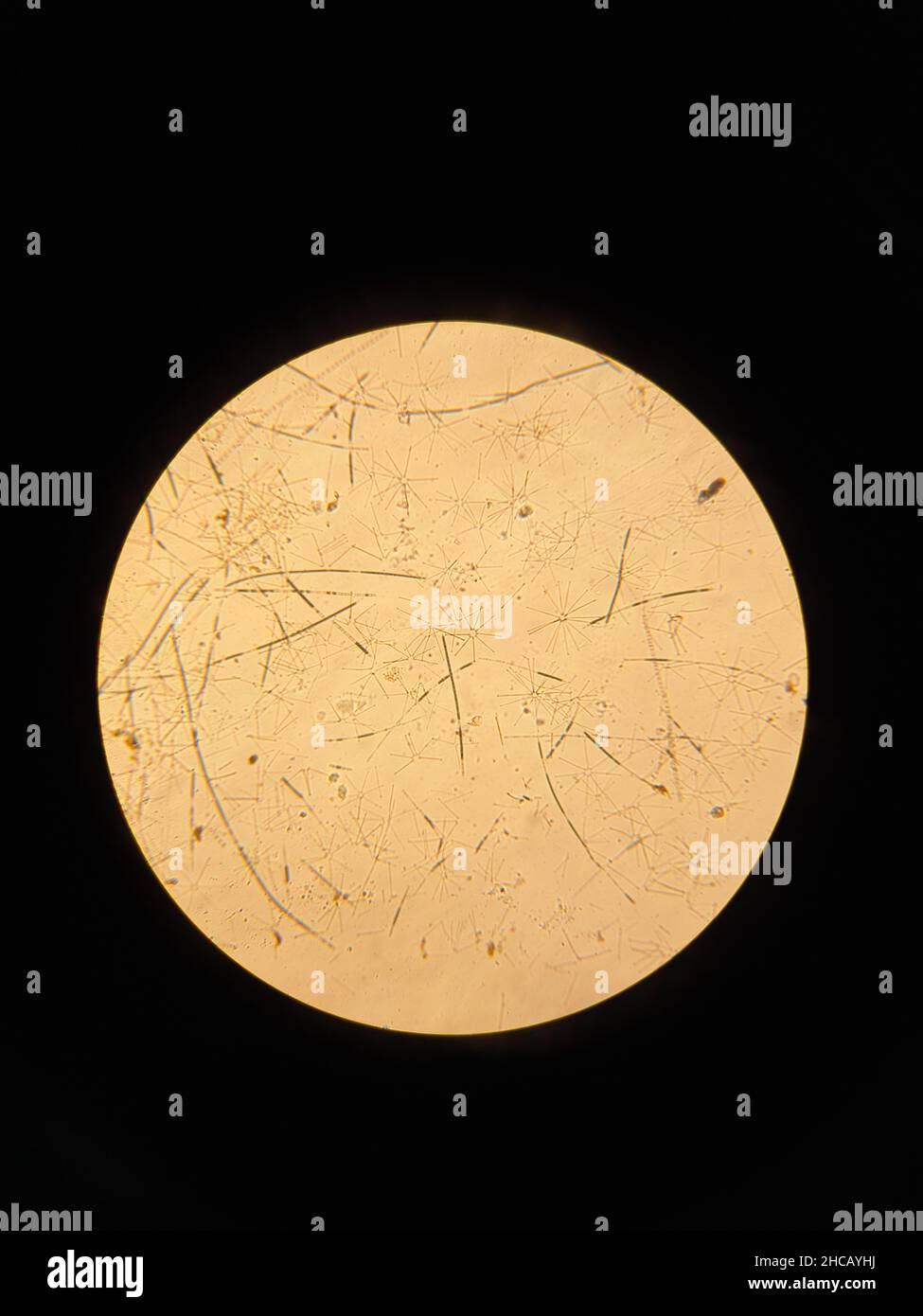 Colonie de diatomées Asterionella sous l'agrandissement d'un microscope à lumière.Photo de haute qualité Banque D'Images