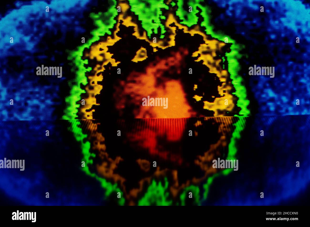 résumé du cancer de l'ordinateur dans le corps Banque D'Images