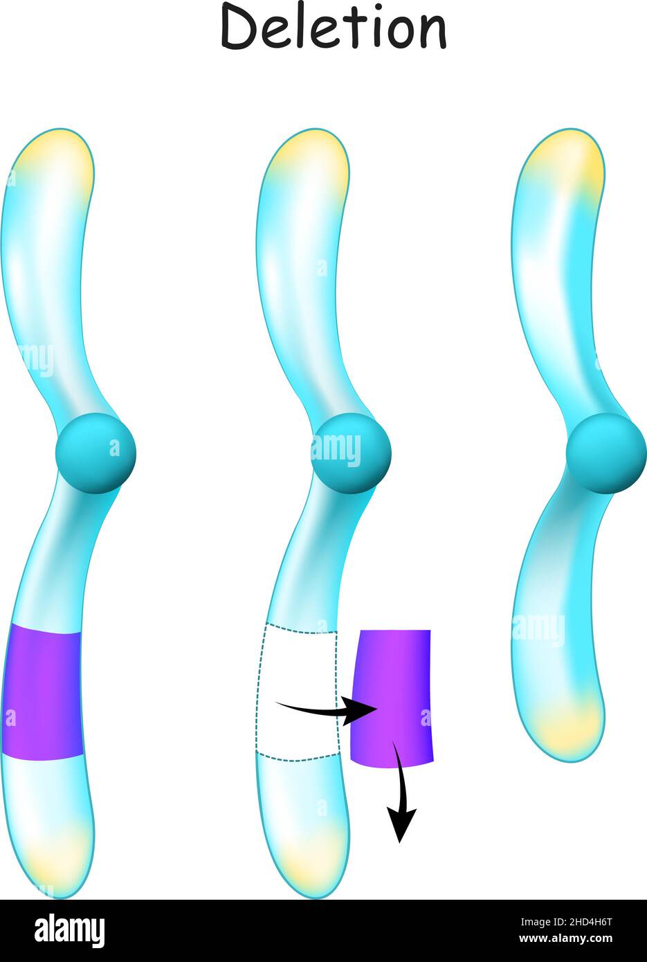 Suppression des chromosomes. Changement dans la structure des chromosomes.Mutation génétique. Une partie d'un chromosome est laissée à l'extérieur pendant la réplication Illustration de Vecteur Suppression des chromosomes. Changement dans la structure des chromosomes.Mutation génétique. Une partie d'un chromosome est laissée à l'extérieur pendant la réplication Illustration de Vecteur