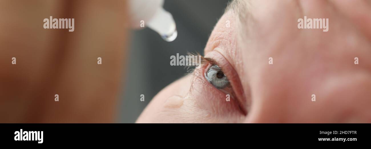 L'homme souffrant d'allergie cutanée digue les gouttes médicales dans les yeux Banque D'Images