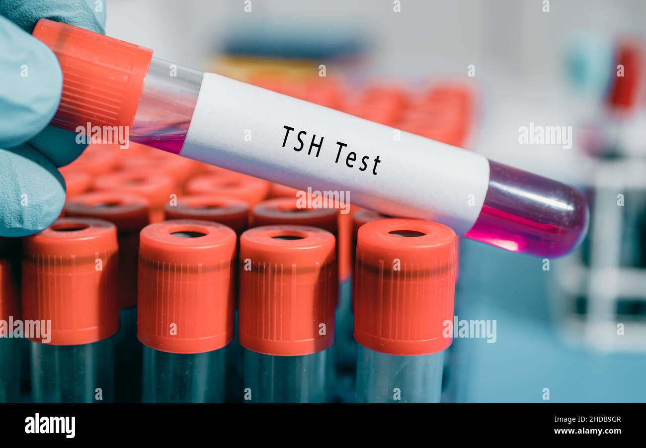 Hormone thyréotrope TSH Test stimule la production et la sécrétion d'hormones thyroïdiennes Banque D'Images