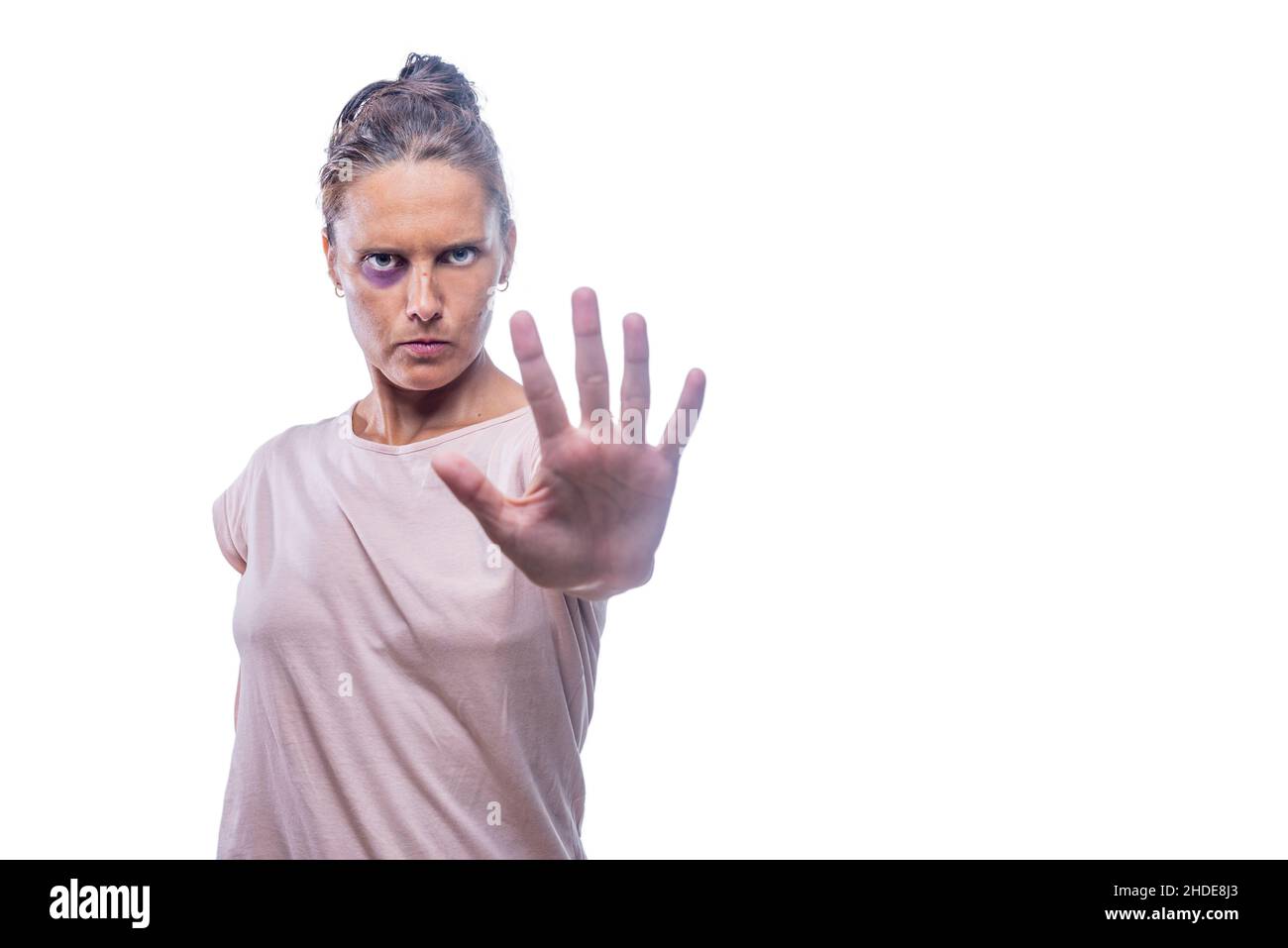 femme avec un œil meurtri montrant un signe d'arrêt contre l'abus de genre Banque D'Images