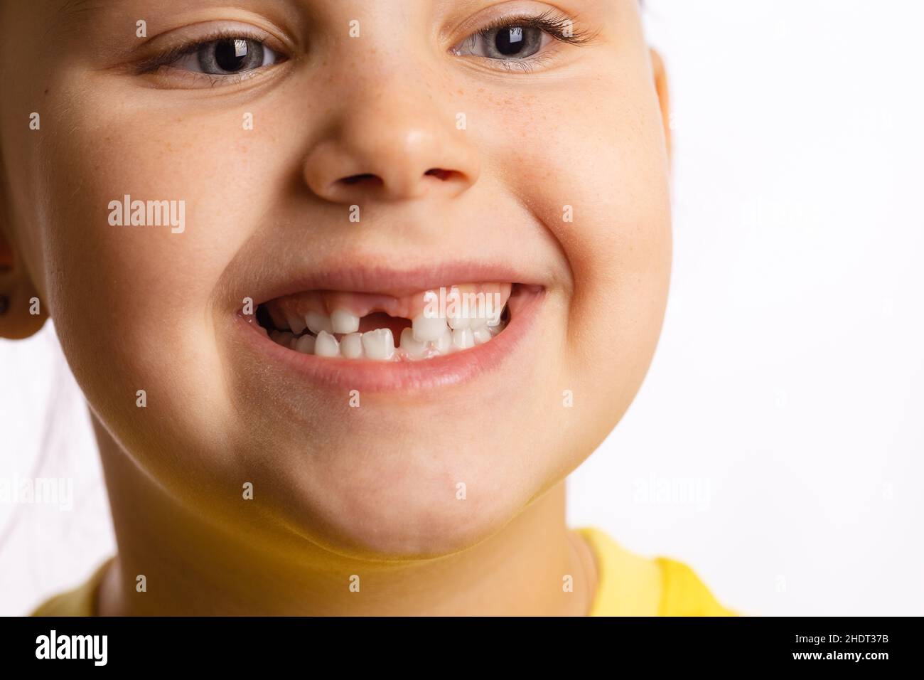 Petite fille visage souriant montrant la dent de bébé avant manquante regardant loin sur fond blanc.Première dent changeant aller chez le dentiste pour faire la dent Banque D'Images