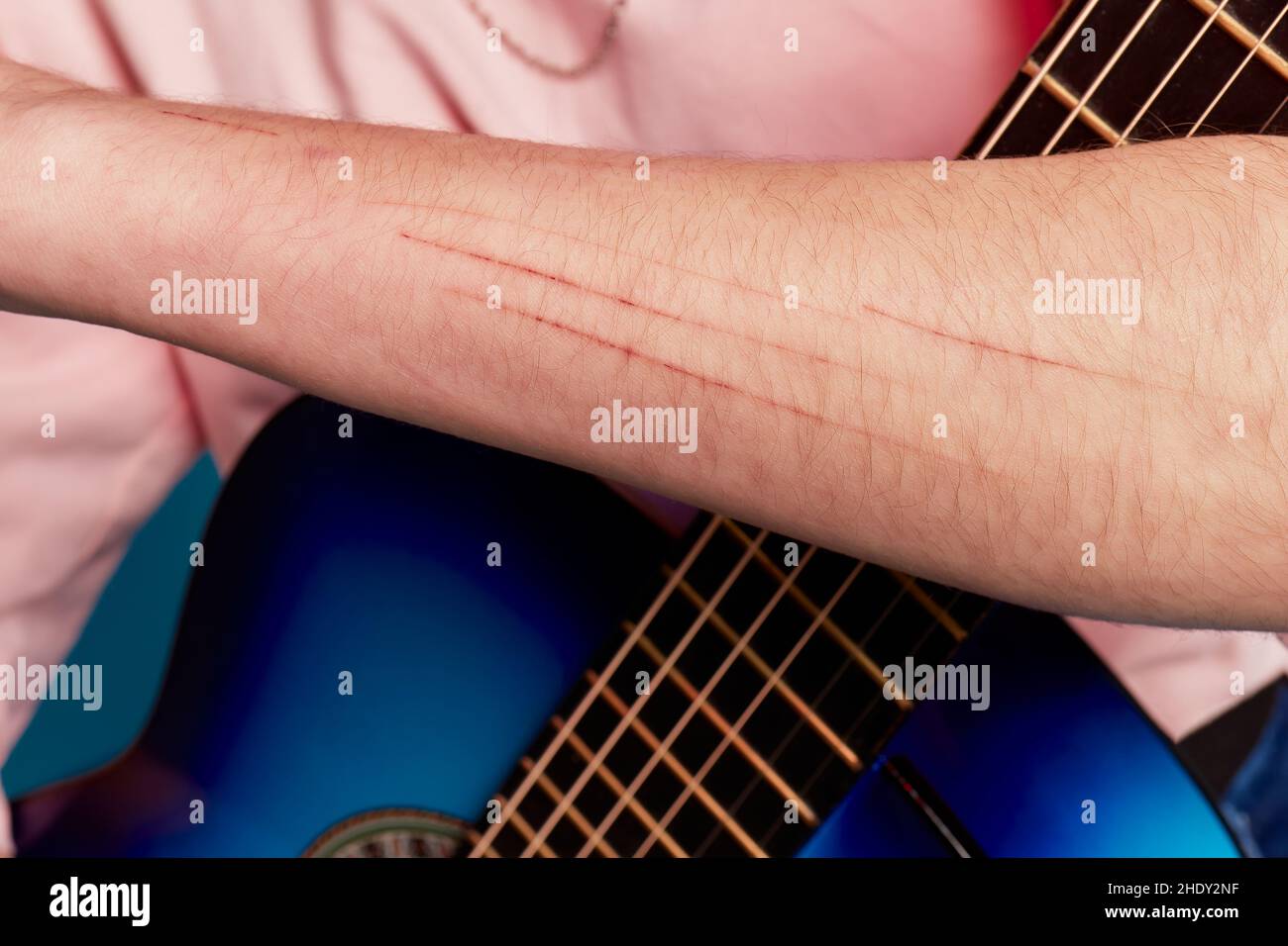 Lesion De La Peau Chat Banque De Photographies Et D Images A Haute Resolution Alamy