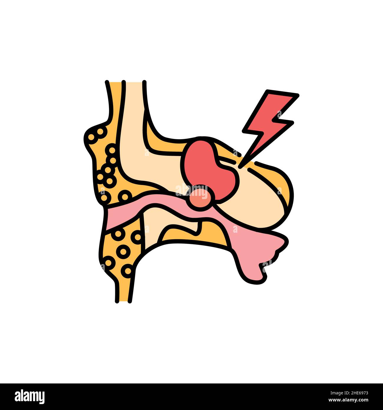 Icône de la ligne de couleur du cholestéatome.Maladies humaines.Pictogramme pour page Web, application mobile, Promo. Illustration de Vecteur