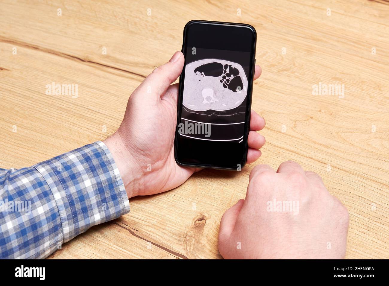 Vieil homme analysant un scan radiographique de son cerveau sur un téléphone.Diagnostic numérique des maladies et technologies de santé Banque D'Images