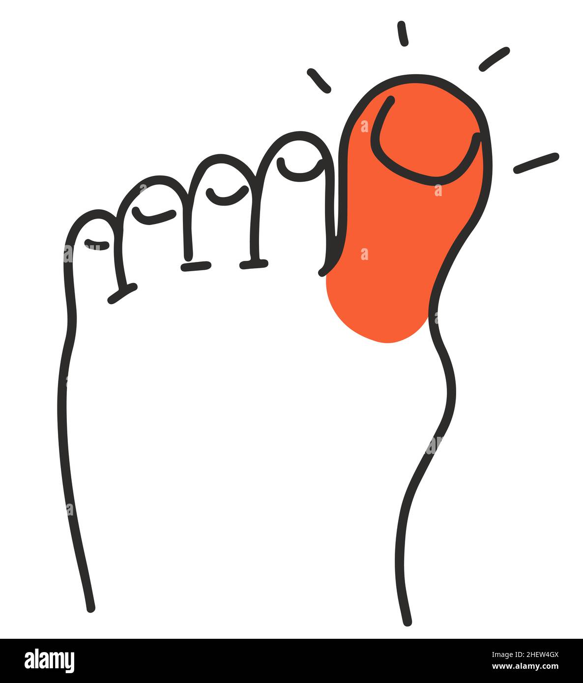 Douleur et rougeur au gros orteil avec goutte. Symptôme maladie Illustration du vecteur Doodle