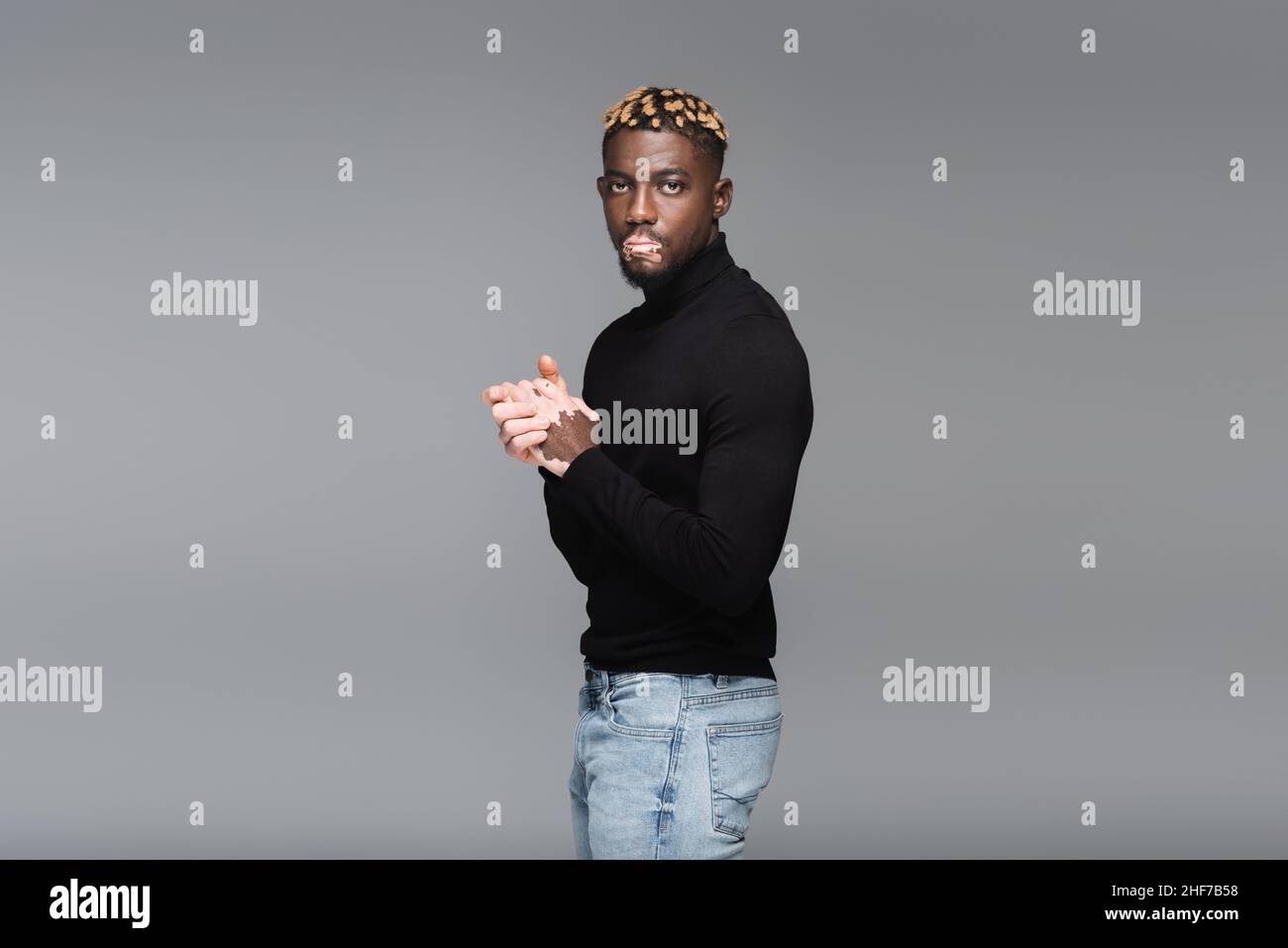 homme afro-américain élégant avec vitiligo, portant un jean et un col roulé noir, regardant la caméra isolée sur le gris Banque D'Images