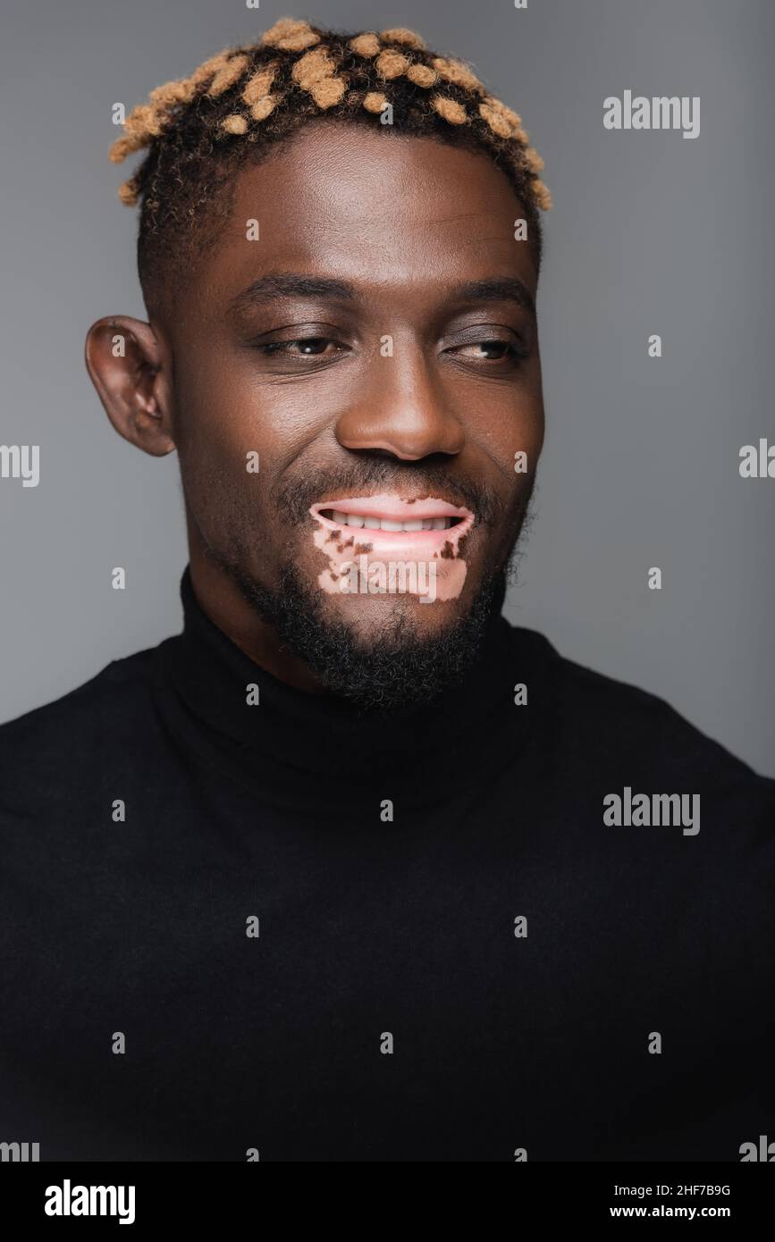 joyeux africain américain avec peau de vitiligo, portant le turtleneck noir isolé sur le gris Banque D'Images