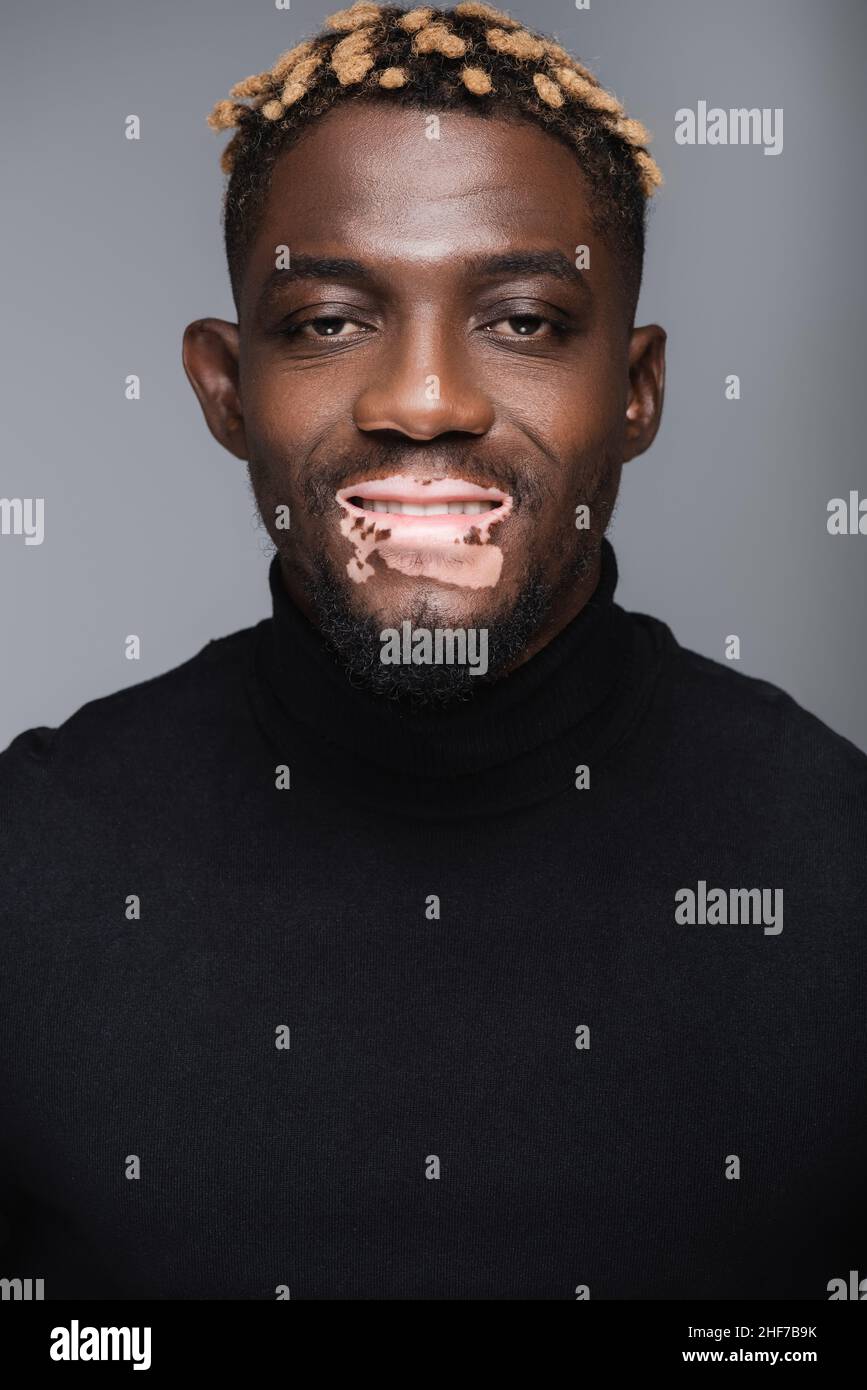 souriant africain américain homme avec le vitiligo et la coiffure élégante regardant l'appareil photo isolé sur gris Banque D'Images