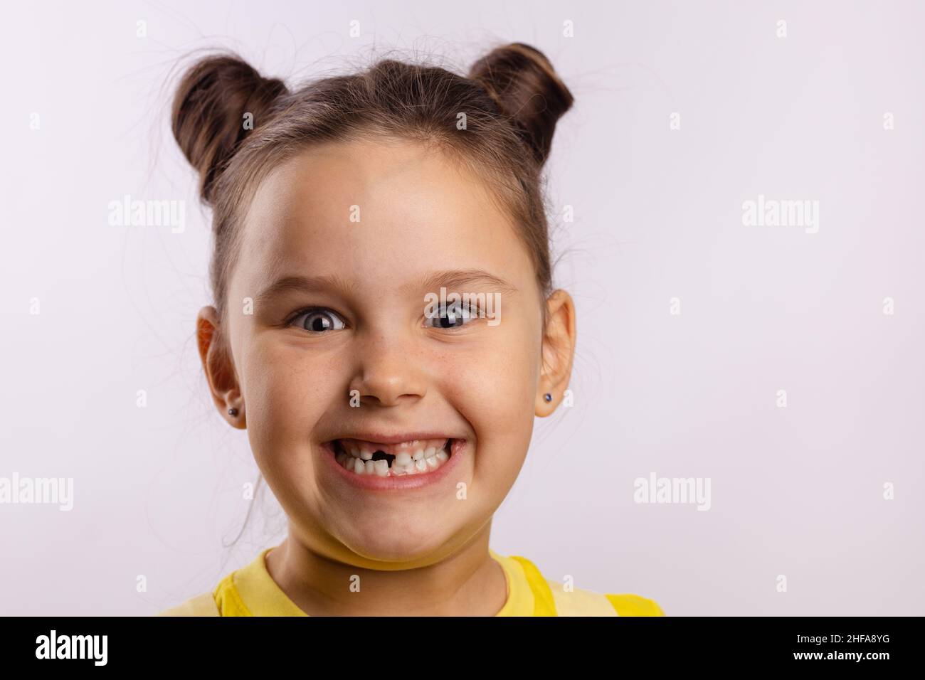 Une jeune fille trop excitée souriant avec des dents avec une dent de lait avant manquante regardant l'appareil photo sur fond blanc.Changement de dents d'abord aller chez le dentiste Banque D'Images