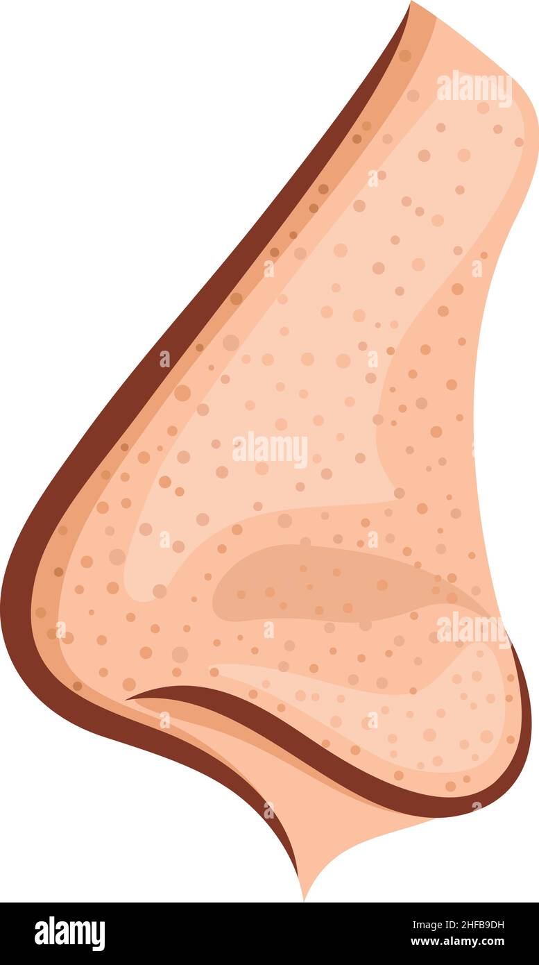 Des têtes noires sur le nez (acné laid). Illustration vectorielle. Illustration de Vecteur