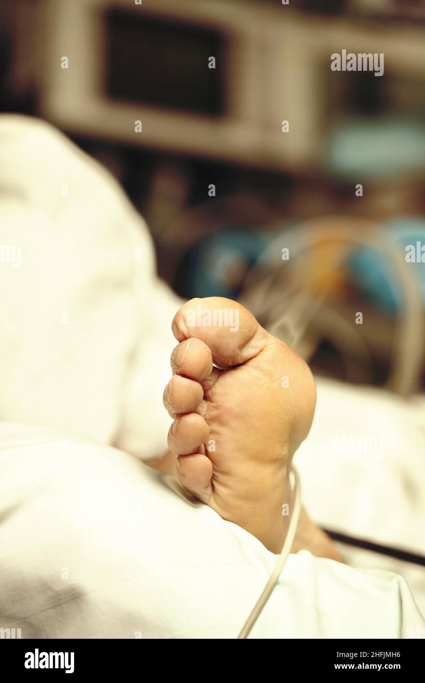 Pied d'un patient âgé épuisé sur un lit blanc au stade avancé d'une maladie, concept d'un état désespéré du patient. Banque D'Images Pied d'un patient âgé épuisé sur un lit blanc au stade avancé d'une maladie, concept d'un état désespéré du patient. Banque D'Images