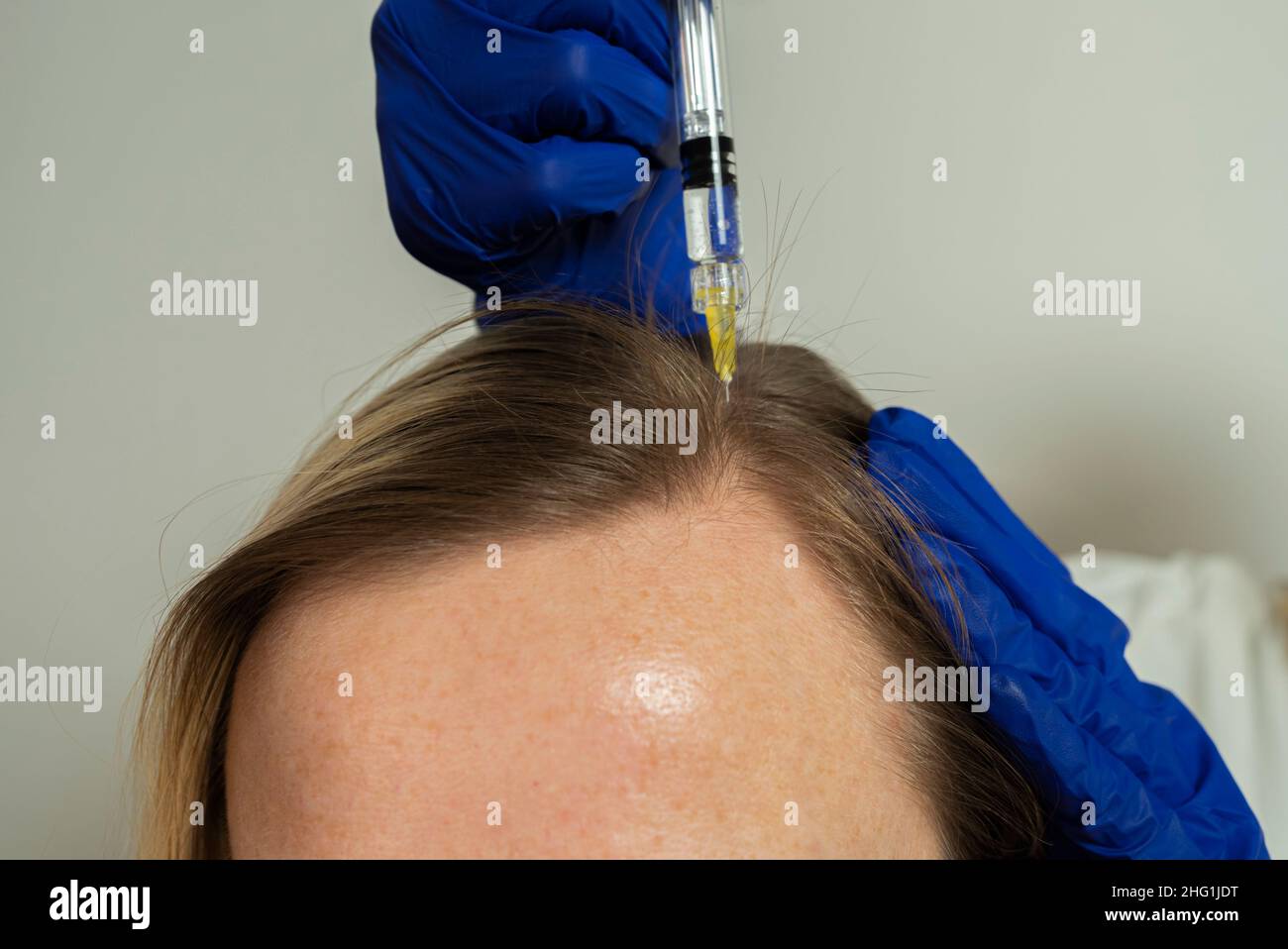 Aiguille de cheveux Banque de photographies et d'images à haute résolution  - Alamy