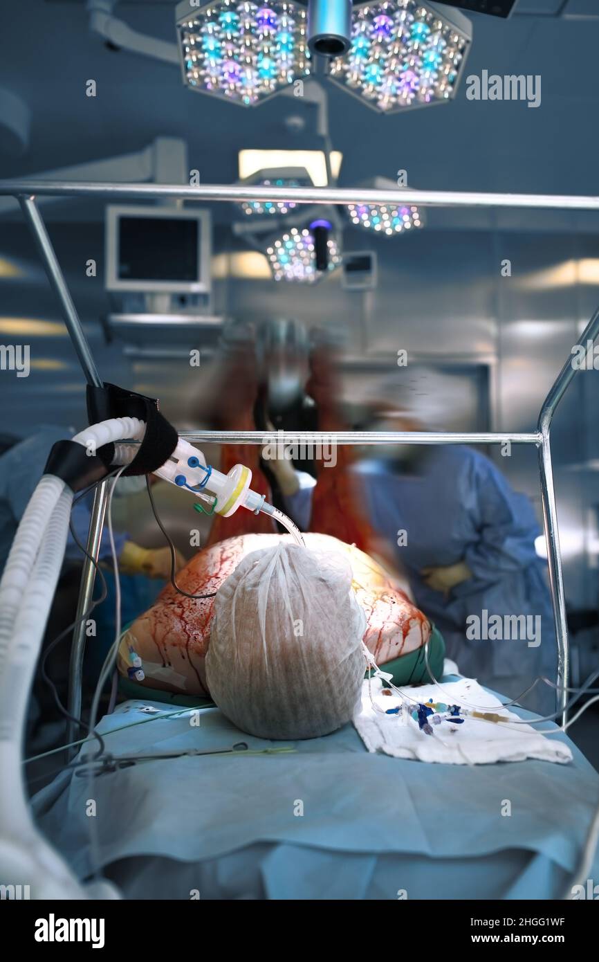 Préparation du patient avant le début de la chirurgie dans la salle d