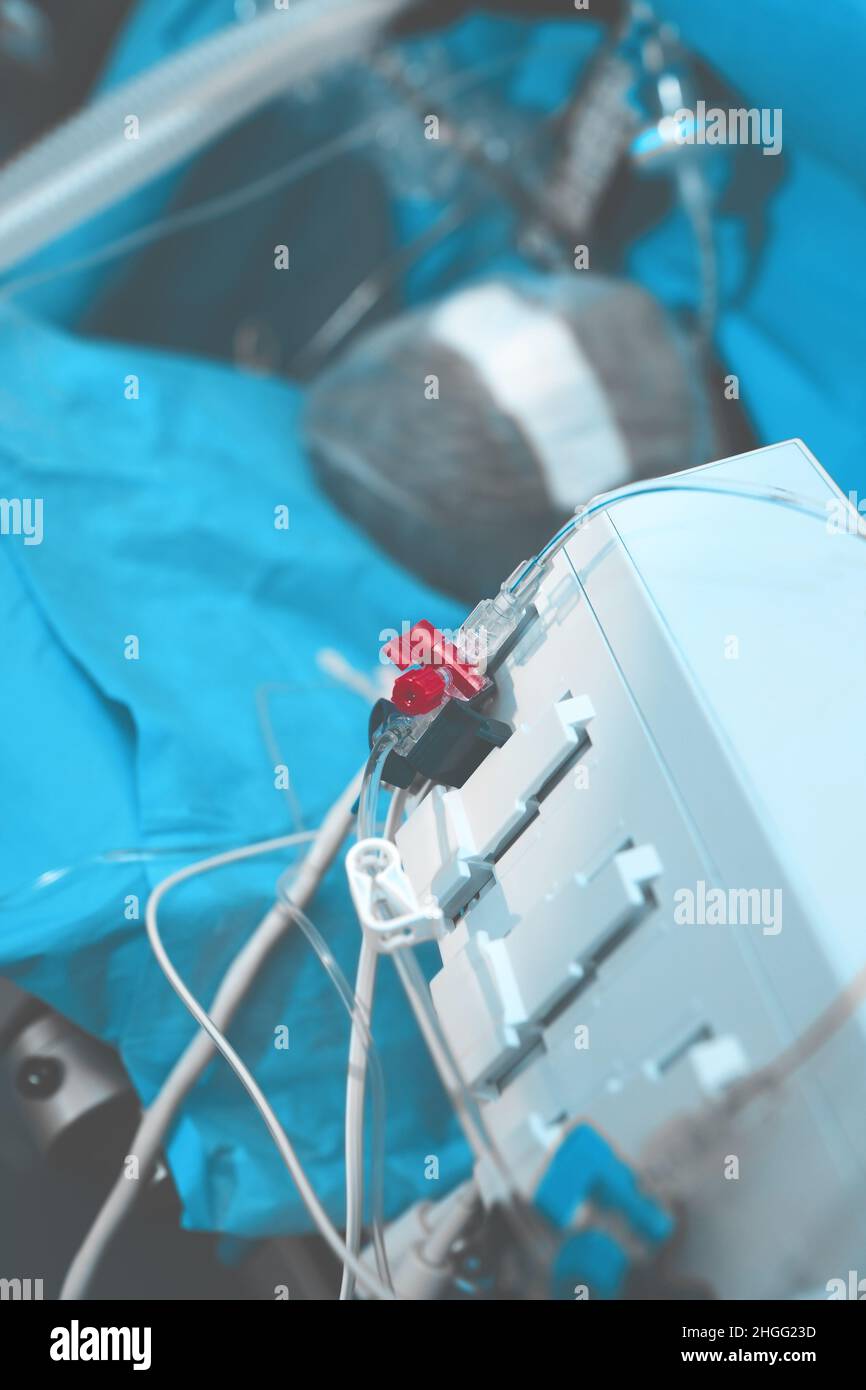 Patient sur la table d'opération connecté au ventilateur et à un autre équipement numérique. Banque D'Images