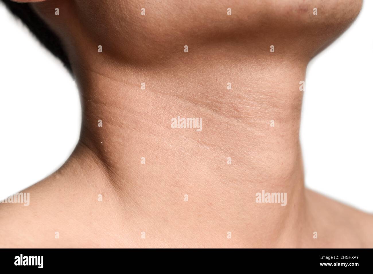 La peau vieillissante se plie ou se froisse ou se froisse au cou de l'homme chinois d'Asie du Sud-est.Concept de mal de gorge, pharyngite ou laryngite.Thyroïde proéminente Banque D'Images