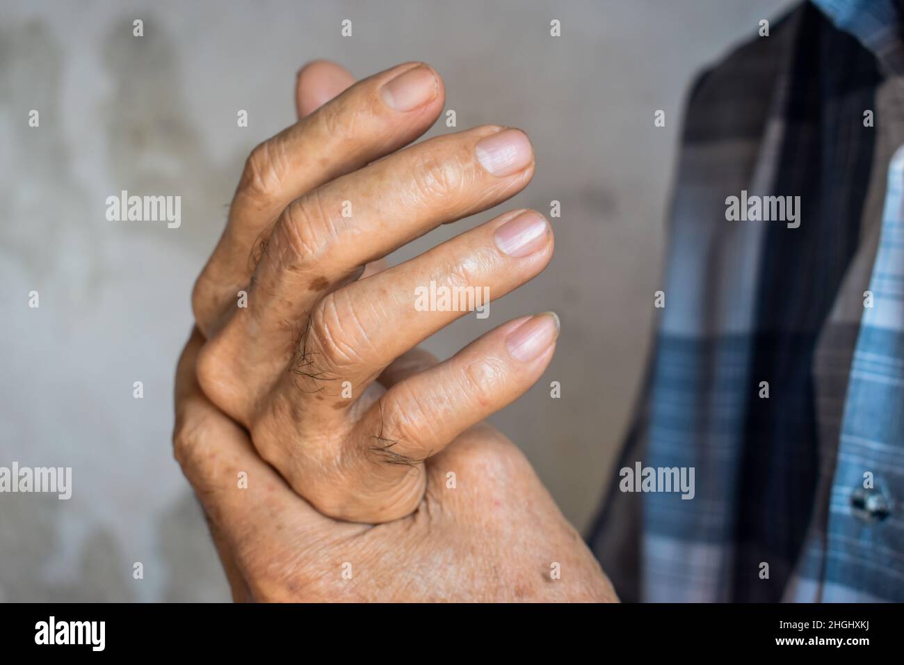 Les doigts et les mains de l'homme asiatique aîné.Concept de la douleur de main, de la polyarthrite rhumatoïde et de la santé des doigts et des problèmes. Banque D'Images