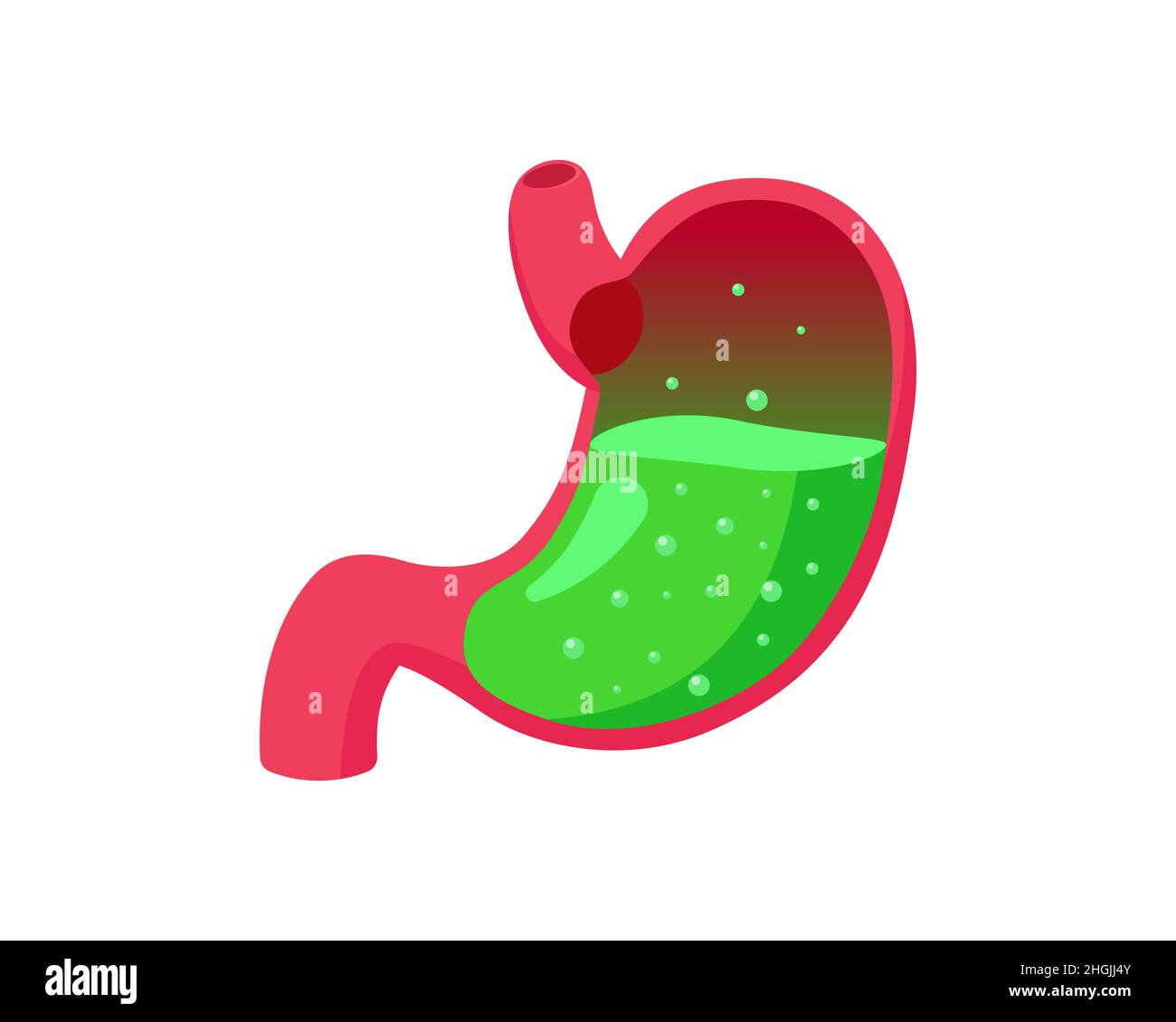 Reflux gastro-intestinal ou empoisonnement avec de l'acide liquide vert à l'intérieur.Reflux gastro-oesophagien maladie du ventre.Problème de brûlures d'estomac du système digestif.Nausées et indigestion.Douleur gastrique abdominale illustration médicale Illustration de Vecteur