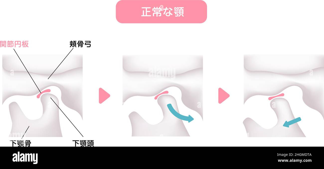 Illustration structurelle lors de l'ouverture et de la fermeture de la mâchoire Illustration de Vecteur