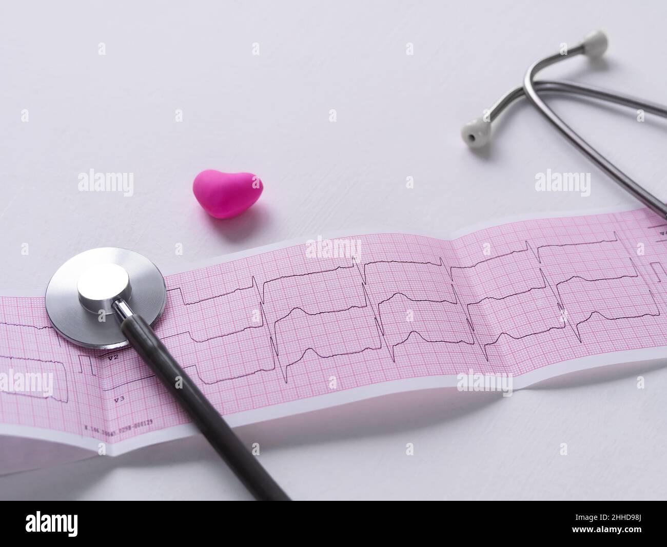 ECG diagramme papier phonendoscope examen médical fond.Cardiogramme de jeune adulte prévenir la maladie, prolapsus de la valve mitrale ou click-murmur syndr Banque D'Images
