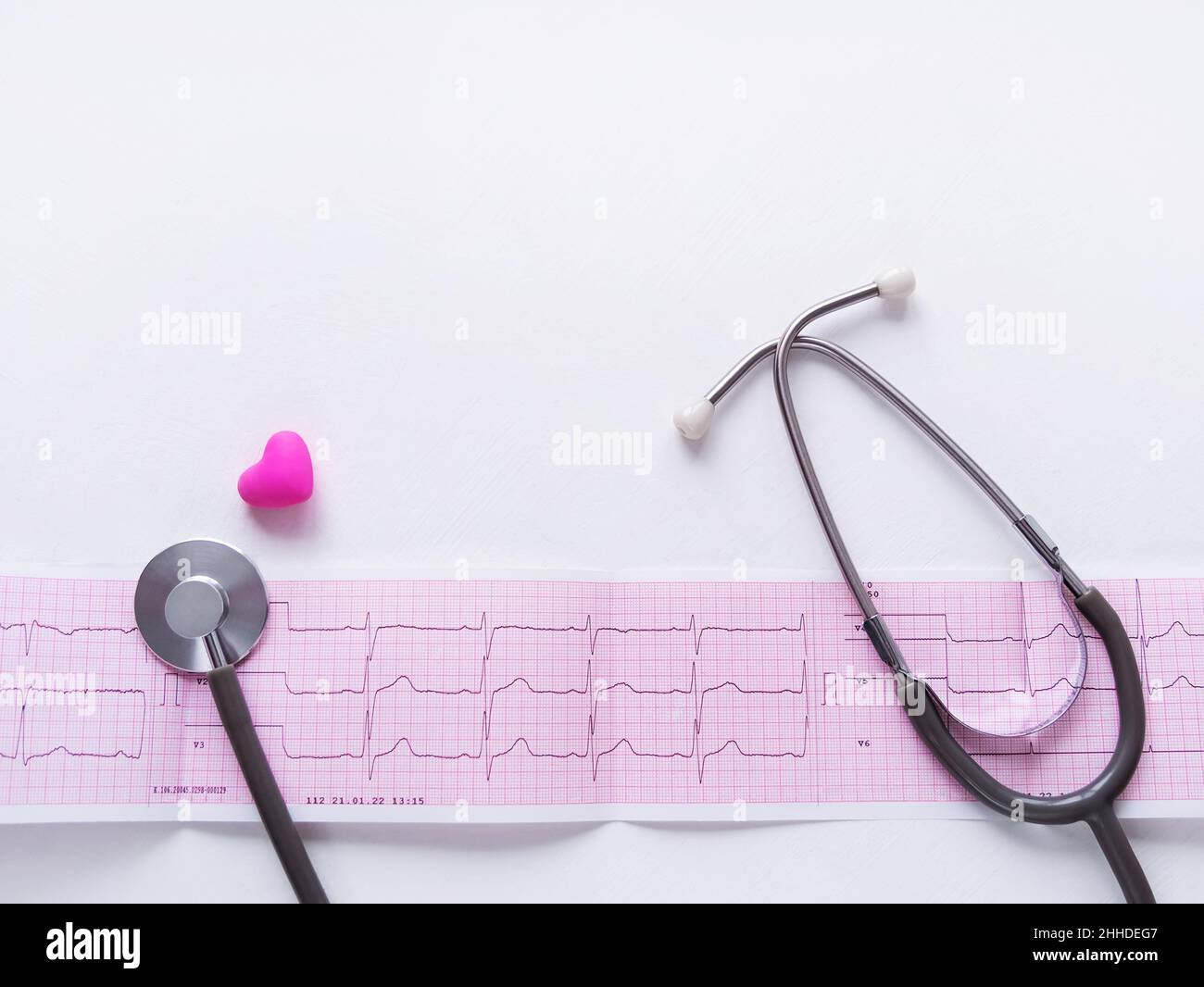 ECG diagramme papier phonendoscope examen médical fond.Cardiogramme de jeune adulte prévenir la maladie, prolapsus de la valve mitrale ou click-murmur syndr Banque D'Images