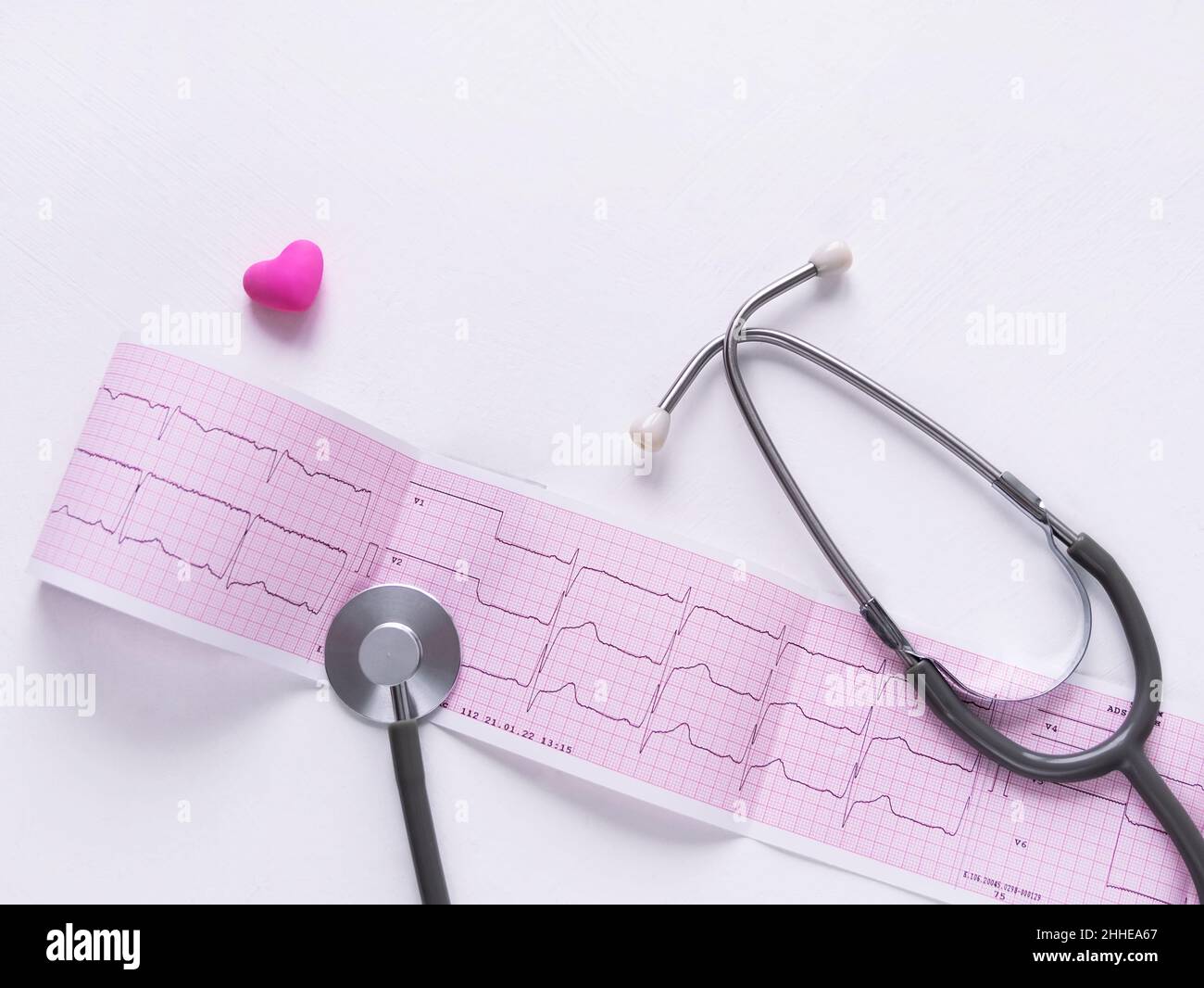 ECG diagramme papier phonendoscope examen médical fond.Cardiogramme de jeune adulte prévenir la maladie, prolapsus de la valve mitrale ou click-murmur syndr Banque D'Images