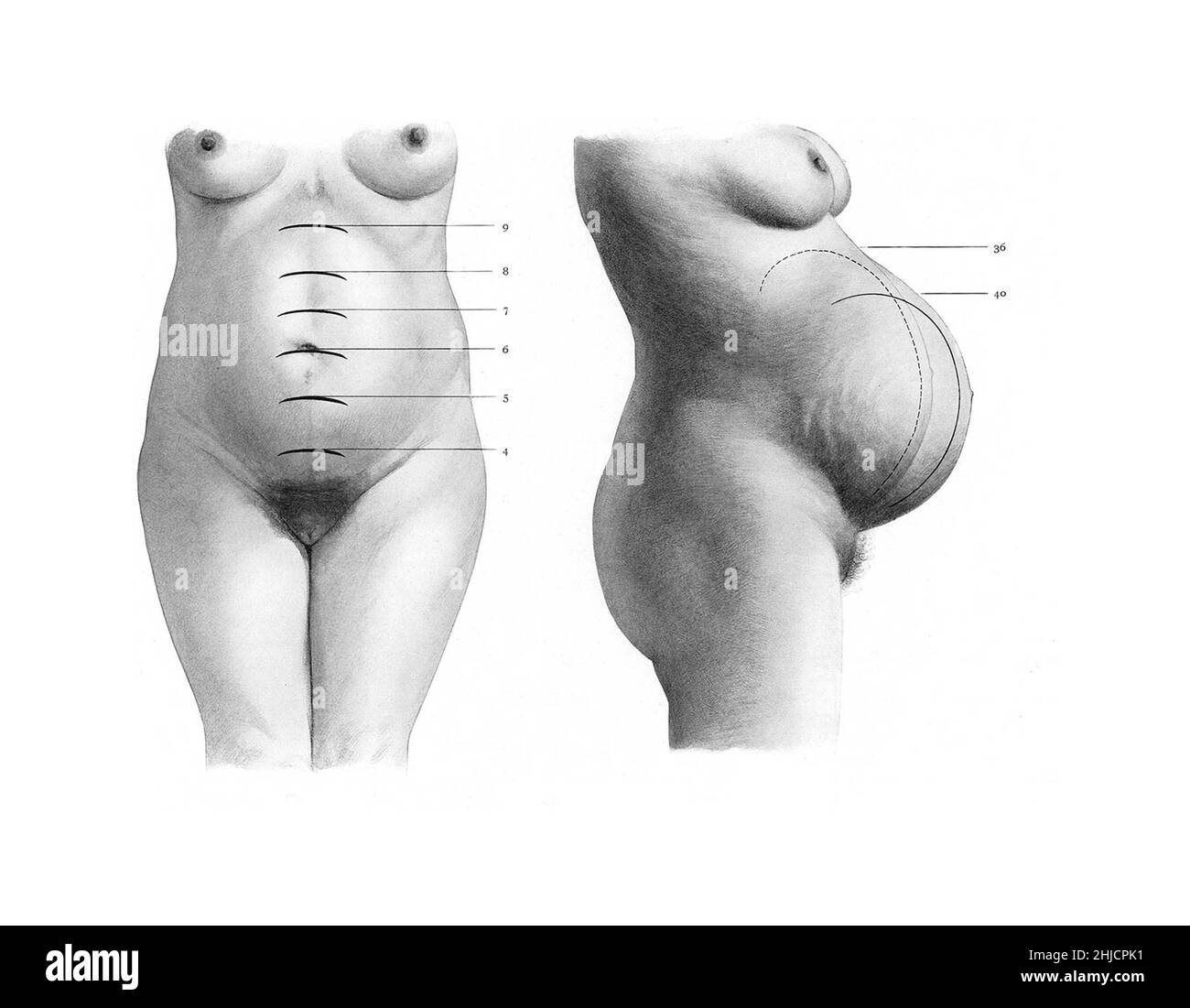 Pendant la grossesse, l'utérus se développe, ce qui représente une partie plus grande et plus importante de l'abdomen de la femme. À gauche se trouve la vue antérieure avec les mois étiquetés ; à droite se trouve une vue latérale portant l'étiquette des 4 dernières semaines. Au cours des dernières étapes de la gestation avant l'accouchement, le fœtus et l'utérus chuteront en position basse. Banque D'Images