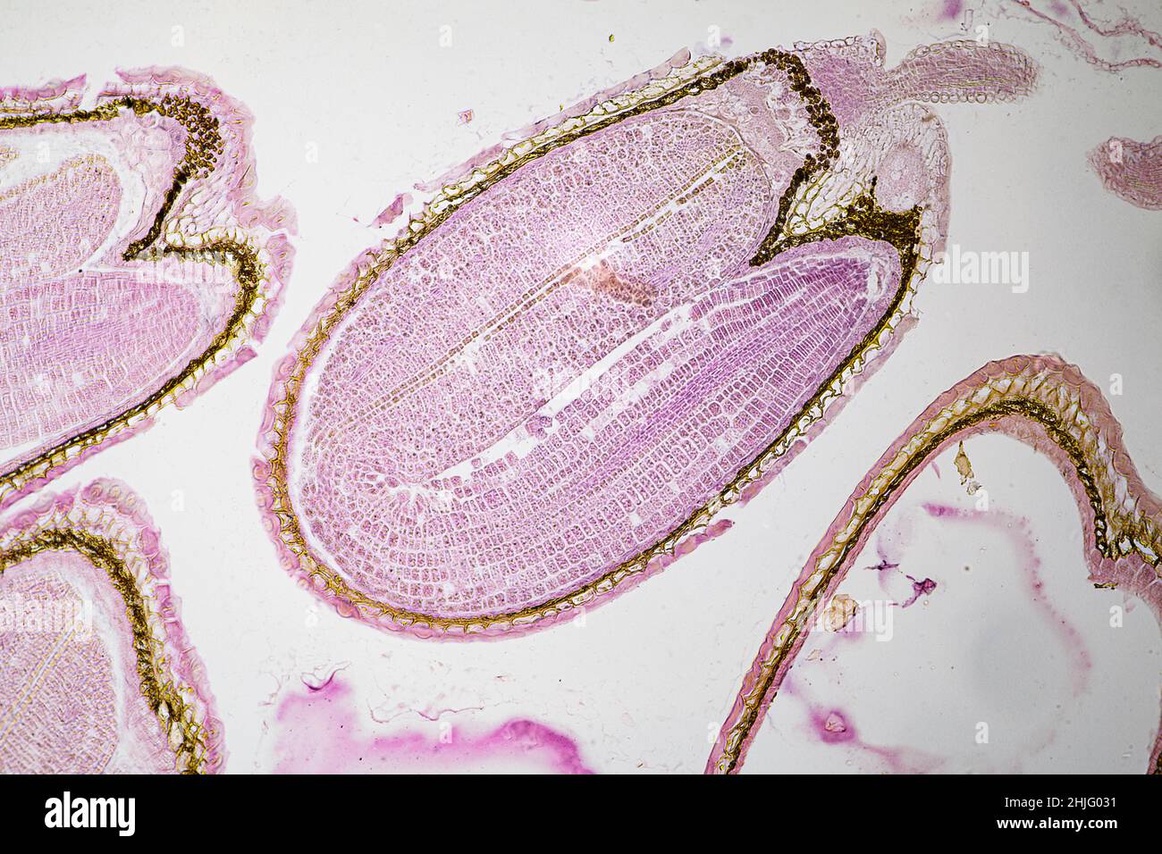 L'embryon de Capsella mature est vu au microscope léger Banque D'Images
