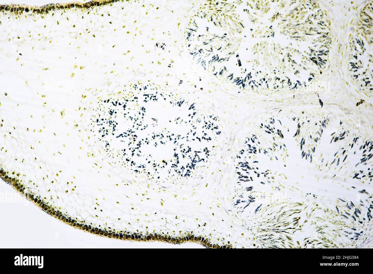 le concepnacle mâle de fucus, vu sous un microscope léger Banque D'Images